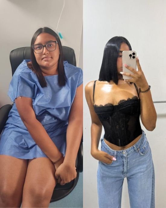 Antes y después paciente 1